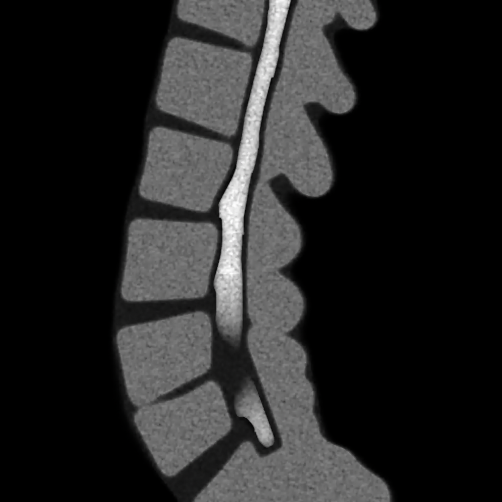 Back Traction Device
