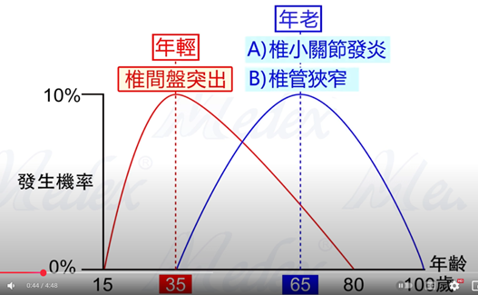 坐骨神經痛與年齡