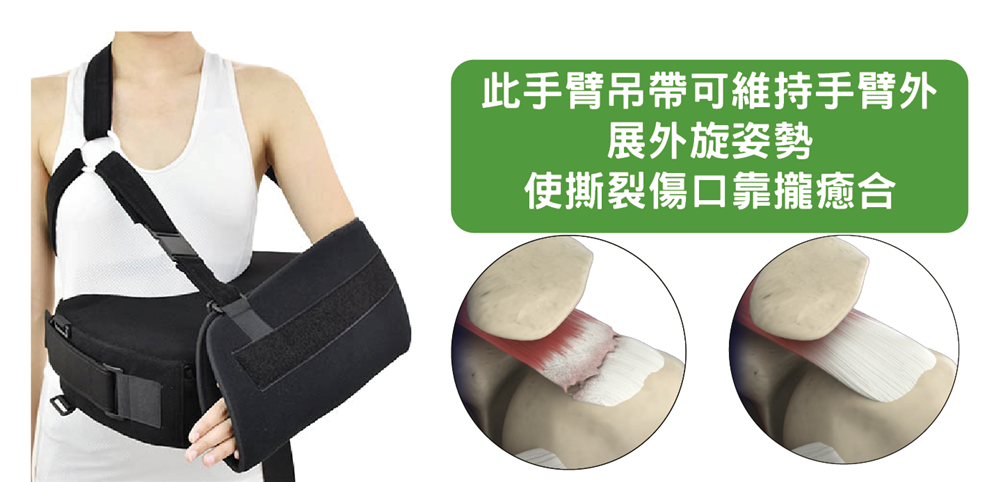旋轉肌袖撕裂手術後
